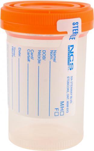 Sterile specimen collection container with orange lid and labeled measurement markings
