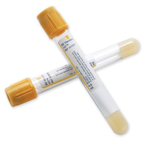 Two yellow-capped blood collection tubes for medical and laboratory use